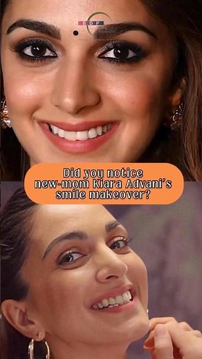 From Cute to Stunning: Kiara Advani’s Smile Transformation! ✨ #kiaraadvani #smilemakeover