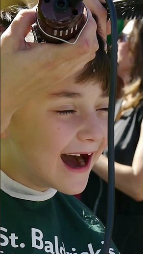 5 Reasons to Go Bald