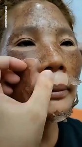 382K views · 1.5K reactions | 7 Days Dark Spots & Pigmentation Removal Challenge | Get Rid Of Dark Spots Naturally, Get Spotless Glowing Skin #skincare #darkspots #pigmentation #spotlessskin #glowingskin | Health Beauty Treat | Facebook