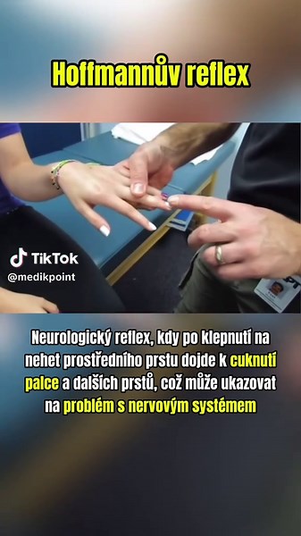 Hoffmannův reflex: Neurologický test v medicíně