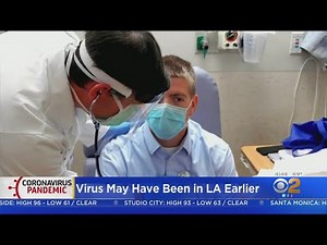 UCLA: COVID-19 Possibly Circulating In LA Back In December