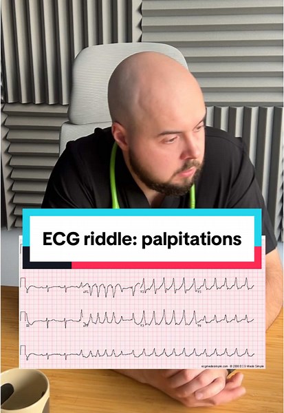 Understanding ECG Riddles: Palpitations Explained