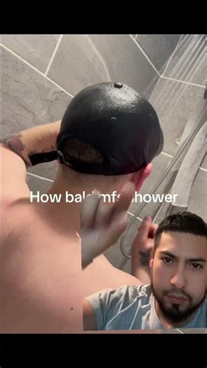 Allmost got em 😂 Want me to remove your cap forever? Free consultations 830-460-5667 #hairtattoo