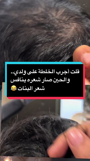 وصفة السدر والأعشاب الهندية لشعر مذهل