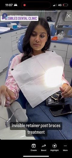 #invisible Essix #retainer simple and easy way to retain teeth post braces treatment #fixretainer