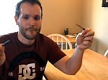 Man pops a giant cyst on his arm - with a tiny samurai sword