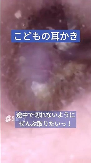 【こどもの耳かき】ピンセットぺりぺり