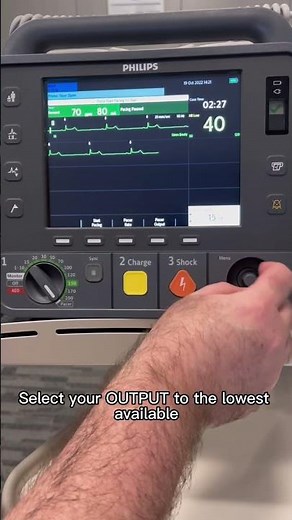Transcutaneous Pacing (TCP) using a Philips Heartstart Intrepid
