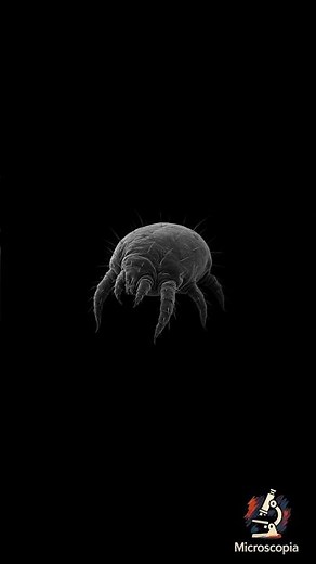 Scabies Mites Are Burrowing Under Your Skin! #insects #science #biology #microscope