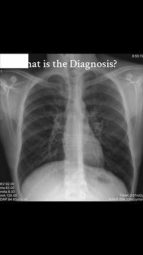 #Interventional #Radiological #Technologist #RADIOLOGY #students @Sayed Nizam Jan Termize