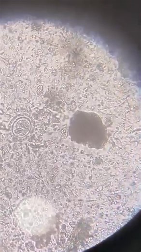 Stool sample 😍 #lablife #MedicalLabTechnician #microbiology | Lab life