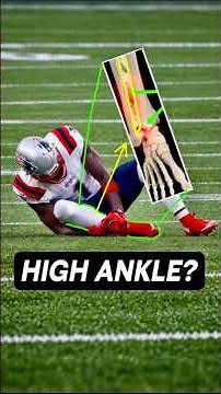 Doctor explains A.J. Brown’s high ankle sprain & return timeline