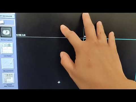 GE CT scanner - Tips & Tricks, General Electric