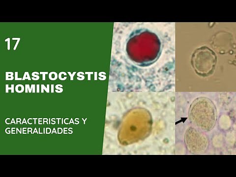 Blastocystis Hominis
