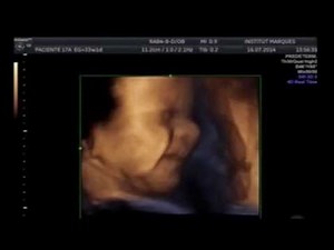 Babies respond to intravaginal music