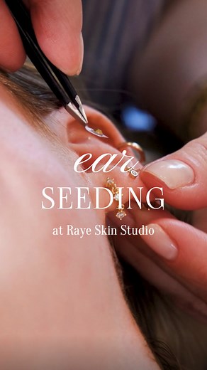 Discover the power of ear seeding 🪄 This ancient acupressure practice uses tiny seeds placed on specific points of the ear to: • Relieve stress tension • Improve sleep quality • Boost mood emotional wellbeing • Support cravings weight goals • Ease anxiety help focus Ready to try it? Book your ear seeding session today or add it onto your next treatment! ✨ #earseeding #earseedingindianapolis #earseedswestfield | Raye Beauty Co