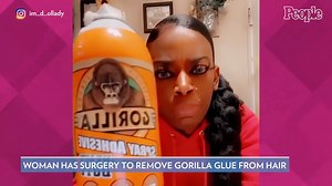 Woman Who Went Viral for Using Gorilla Glue in Her Hair Has Surgery to Remove the Adhesive