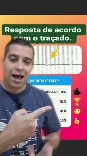 The tracing shows asystole. The "it depends" I'm referring to is due to the analysis of the compl...