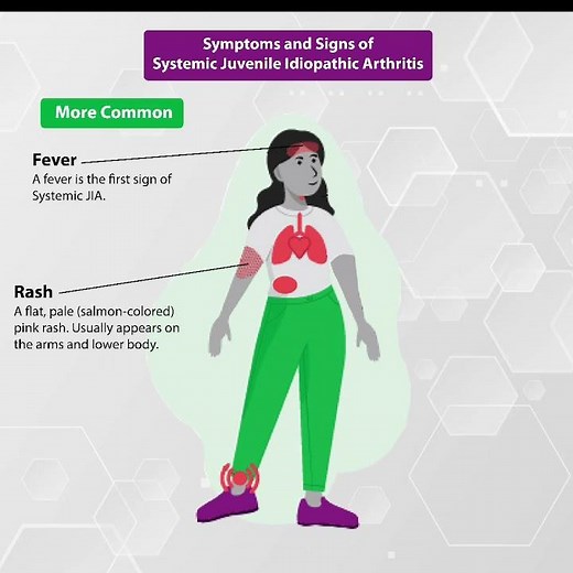 Symptoms and Signs of Systemic Juvenile Idiopathic Arthritis