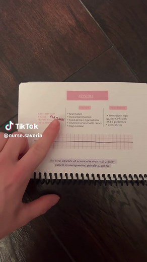 EKG basics! How well do you know asystole? Do you know what to do if your patient goes into asystole? This rhythm requires immediate treatment! #ecg #ekg #ekginterpretation