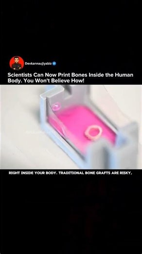 World-First Breakthrough: 3D Printing Bone Directly Into the Human Body #3dprinting #shorts #tech