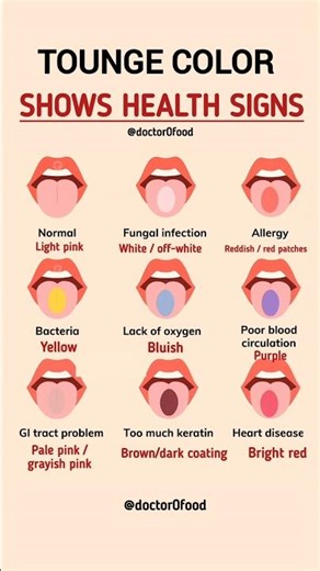 Tongue Colors That Indicate Health Issues | Health Awareness #healthylifestyle #healthyeating