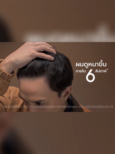 TROS PRO Advanced: แก้ปัญหาผมร่วงใน 6 สัปดาห์