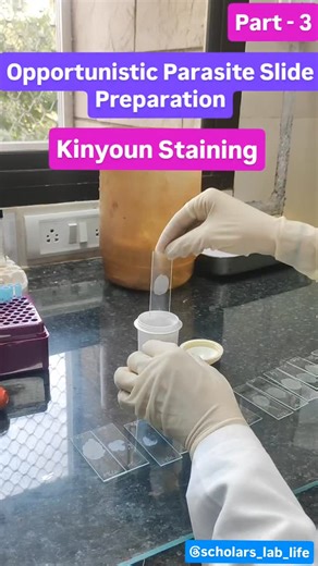 Scholarslablife on Instagram: "Kinyoun staining is a modified acid-fast technique used for the detection of coccidian parasites in stool samples. Follow the page and comment “Kinyoun” to receive procedure PDF #KinyounStain #Microbiology #Parasitology #MedicalLaboratory #LabTechEducation"