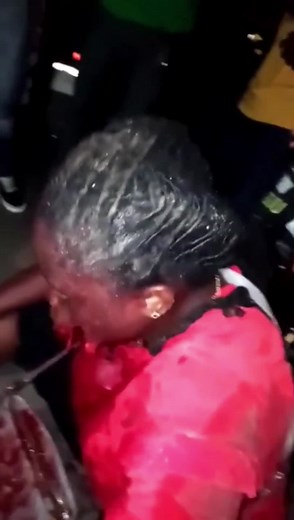 Consequences Of A Shot In The Mouth