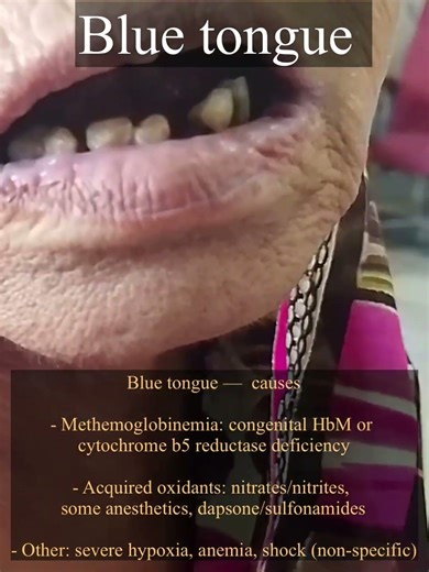 Blue tongue