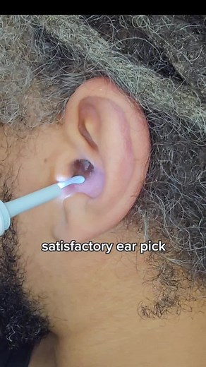 satisfaction guaranteed #earwaxremoval #earwaxremmoval #earcleaningvideos #earcleaningvideo #earclean #earpicking #earpickingcamera #earpickingtool #dryskinpick #weirdlysatisfying
