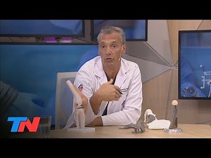 How does a 3D prosthesis work?