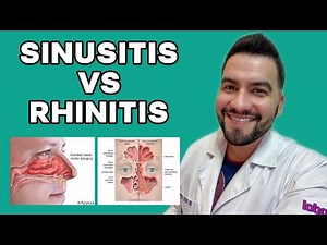 What's the Difference Between Sinusitis and Rhinitis? | Dr. David Campos Explains