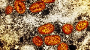 Monkeypox: Everything you need to know about symptoms, spread, treatment and vaccines