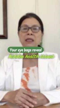 Why Your Eye Bags Change Color (TCM Explains Water Retention & Kidneys)