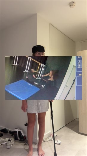 Chungus Head Brain Cancer Update for My Squad