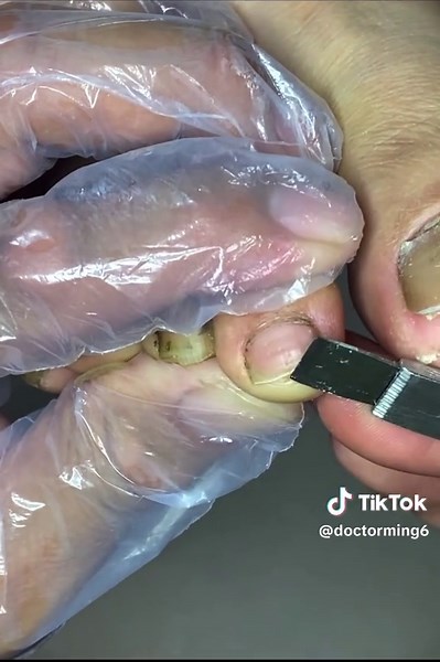 Expert Tips for Achieving the Perfect Pedicure