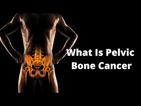 What Is Pelvic Bone Cancer