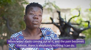 19 reactions | Elephantiasis (lymphatic filariasis) is one of the ten...