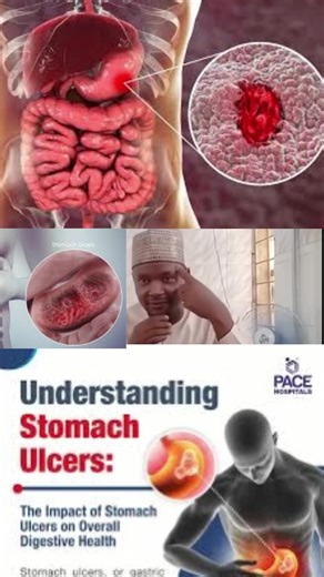 Exploring Islamic Pharmacy and Herbal Medicine in Africa