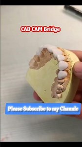 How Do Dentists Make Fake Teeth?
