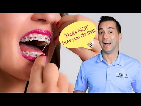 How to Floss with Braces | Water Flosser vs. String Floss