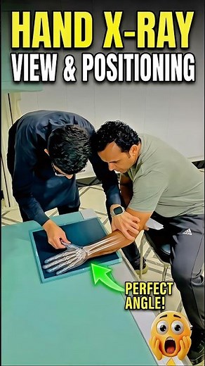 Hand X-ray view & positioning #drnakash2001