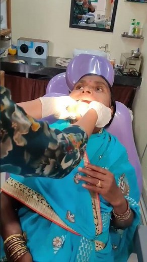 Lock jaw | TMJ adjustment #dentist #tmj #tmjtreatment #lockjaw