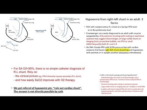 Shunt hemodynamics (left-right and right-left): from simple to complex concepts and calculations