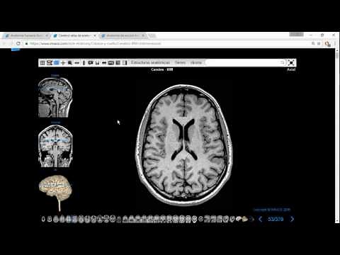 Resonancia Magnética de Cabeza para Anatomía