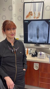 Benefits of warming composites:🤩 ✅ Improved conversion ✅ Better adaptation ✅ Less invasive preps needed ✅ Stronger physical properties ✅ Better handling But before you warm your composite- make sure the materials you are using can tolerate the heat!🔥🌡️ Check out this reference and learn more now➡️ https://link.springer.com/article/10.1007/s00784-020-03637-2 #dentaleconomics #warming #composite #dentist #dentalhygiene #dentistry #dentistrylife #dentaloffice #sciencebased | Dental Economics