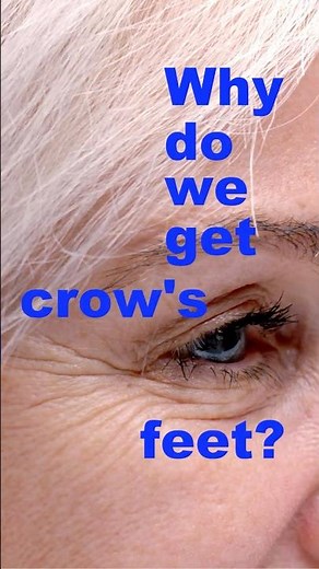 Why Do We Get Crow's Feet? Doctor Explains