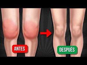 How to Reduce Knee Inflammation at Home WITHOUT Medication (Lying Down)