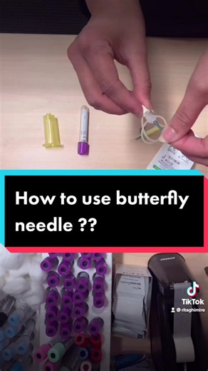 Butterfly Needle: Procedure, Techniques, and Safety Measures